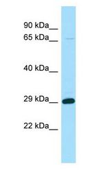 STARD6 antibody Western Blot of Fetal Kidney.