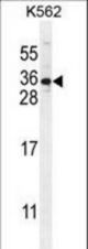 STARD6 Antibody western blot of K562 cell line lysates (35 ug/lane). The STARD6 antibody detected the STARD6 protein (arrow).