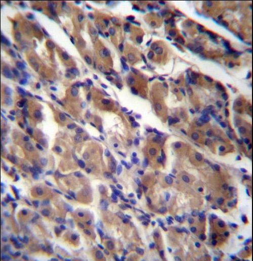 ABRA Antibody immunohistochemistry of formalin-fixed and paraffin-embedded human stomach tissue followed by peroxidase-conjugated secondary antibody and DAB staining.