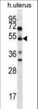 ABRA Antibody western blot of human normal Uterus tissue lysates (35 ug/lane). The ABRA antibody detected the ABRA protein (arrow).