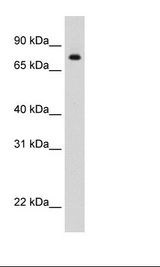 Recombinant STAT1 Protein Cell Lysate.