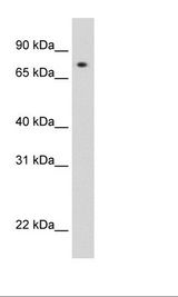 Recombinant STAT1 protein Cell Lysate
