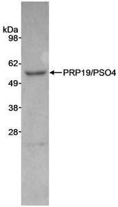 Detection of human PRP19/PSO4 by Western Blot. Samples: Whole cell lysate (40 ug for WB) from Jurkat cells. Antibody: Affinity purified rabbit anti-PRP19/PSO antibody used at 1 ug/ml. Detection: Chemiluminescence with an exposure time of 2 minutes.