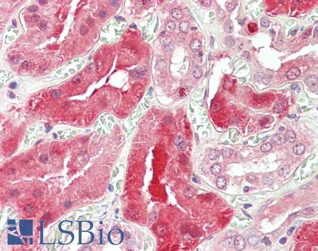 Anti-STAT3 antibody IHC staining of human kidney. Immunohistochemistry of formalin-fixed, paraffin-embedded tissue after heat-induced antigen retrieval. Antibody LS-B11150 concentration 5 ug/ml.