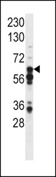 Western blot of anti-Phospho-STAT3 Pabin mouse liver tissue lysate (35 ug/lane). Phospho-STAT3(arrow) was detected using the purified antibody.