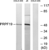 Western blot of extracts from COLO/Jurkat cells, using PRPF19 Antibody. The lane on the right is treated with the synthesized peptide.