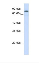 Fetal muscle lysate. Antibody concentration: 1.0 ug/ml. Gel concentration: 12%.