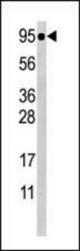 Western blot of anti-Phospho-STAT5a-S726 Antibody in CEM cell line lysate (35 ug/lane). Phospho-STAT5a(arrow) was detected using the purified antibody.
