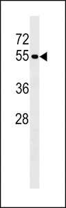 PTPN18 Antibody western blot of MDA-MB231 cell line lysates (35 ug/lane). The PTPN18 antibody detected the PTPN18 protein (arrow).