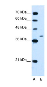 PTPN2 / TCPTP antibody LS-C40517 Western blot of Jurkat lysate.