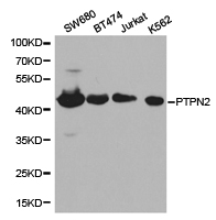 Western blot of extracts of various cell lines, using PTPN2 antibody.