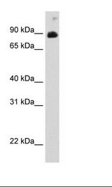 Recombinant STAT6 Protein Cell Lysate