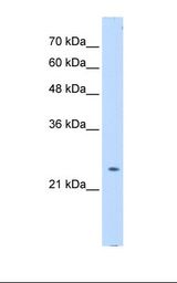 Transfected 293T cell lysate. Antibody concentration: 0.5 ug/ml. Gel concentration: 12%.