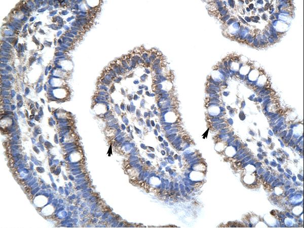 STAU1 / Staufen antibody LS-C31702 was used in IHC to stain formalin-fixed, paraffin-embedded human intestine.