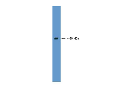 WB: 1 ug/ml on mouse pancreas