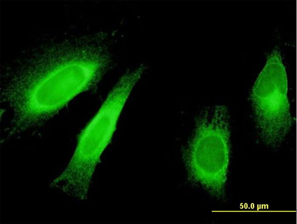 Immunofluorescence of monoclonal antibody to STAU1 on HeLa cell . [antibody concentration 10 ug/ml]