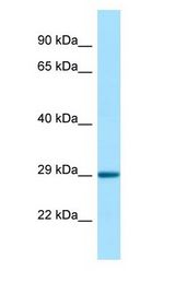 STC1 / Stanniocalcin antibody Western Blot of Rat Pancreas.