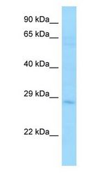 STC2 / Stanniocalcin 2 antibody Western Blot of MCF7.