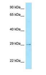 STC2 / Stanniocalcin 2 antibody Western Blot of Fetal Heart.