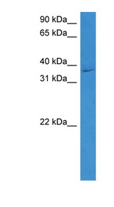 STEAP1 antibody LS-C135043 Western blot of THP-1 cell lysate.