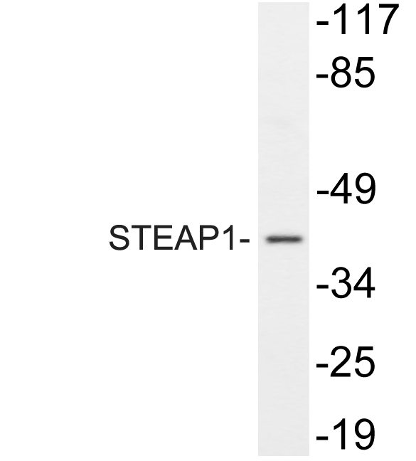 Western blot of STEAP1 (D31) pAb in extracts from A549.