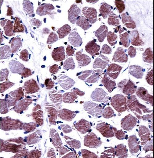 STEAP1 Antibody immunohistochemistry of formalin-fixed and paraffin-embedded human skeletal muscle followed by peroxidase-conjugated secondary antibody and DAB staining.