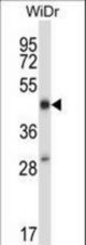 STEAP1 Antibody western blot of WiDr cell line lysates (35 ug/lane). The STEAP1 antibody detected the STEAP1 protein (arrow).
