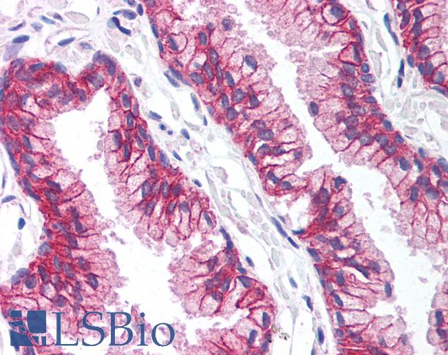 Anti-STEAP1 antibody IHC of human prostate. Immunohistochemistry of formalin-fixed, paraffin-embedded tissue after heat-induced antigen retrieval. Antibody LS-B1260 concentration 10 ug/ml.