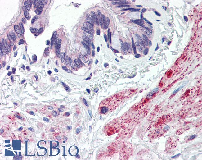 Anti-STEAP1 antibody IHC of human lung, bronchiole. Immunohistochemistry of formalin-fixed, paraffin-embedded tissue after heat-induced antigen retrieval. Antibody LS-B2828 concentration 5 ug/ml.