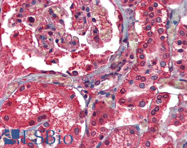 Anti-STEAP1 antibody IHC of human kidney. Immunohistochemistry of formalin-fixed, paraffin-embedded tissue after heat-induced antigen retrieval. Antibody LS-B3801 concentration 5 ug/ml.