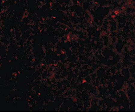 Immunofluorescence of STEAP1 in human spleen tissue with STEAP1 antibody at 20 ug/ml.