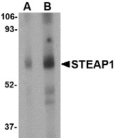 Western blot of human spleen tissue lysate with STEAP1 antibody at (A) 1 and (B) 2 ug/ml.