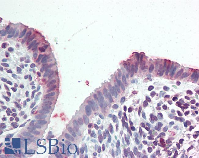 Anti-STEAP2 antibody LS-A9242 IHC of human uterus. Immunohistochemistry of formalin-fixed, paraffin-embedded tissue after heat-induced antigen retrieval.