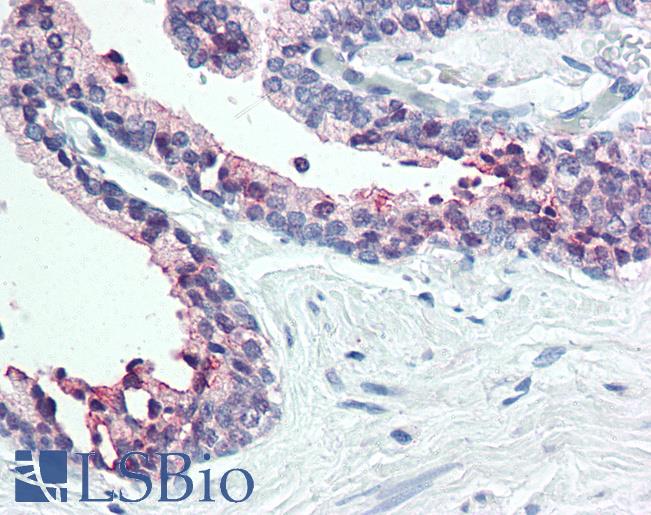 Anti-STEAP2 antibody LS-A9242 IHC of human prostate. Immunohistochemistry of formalin-fixed, paraffin-embedded tissue after heat-induced antigen retrieval.