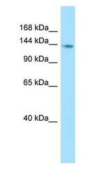 PTPN21 / PTPD1 antibody Western Blot of ACHN.