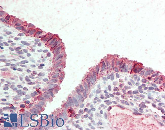 Anti-STEAP2 antibody LS-A9239 IHC of human uterus. Immunohistochemistry of formalin-fixed, paraffin-embedded tissue after heat-induced antigen retrieval.