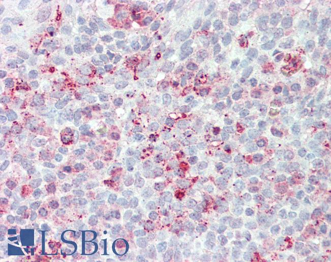 Anti-STEAP2 antibody LS-A9239 IHC of human tonsil. Immunohistochemistry of formalin-fixed, paraffin-embedded tissue after heat-induced antigen retrieval.
