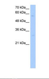 Jurkat cell lysate. Antibody concentration: 1.0 ug/ml. Gel concentration: 12%.