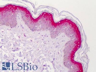 Anti-STEAP4 antibody IHC of human skin. Immunohistochemistry of formalin-fixed, paraffin-embedded tissue after heat-induced antigen retrieval. Antibody LS-B4904 concentration 10 ug/ml.