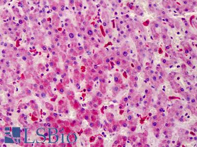 Anti-STEAP4 antibody IHC of human liver. Immunohistochemistry of formalin-fixed, paraffin-embedded tissue after heat-induced antigen retrieval. Antibody LS-B4904 concentration 10 ug/ml.