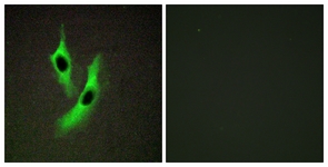Immunofluorescence of HeLa cells, using STEAP4 Antibody. The picture on the right is treated with the synthesized peptide.