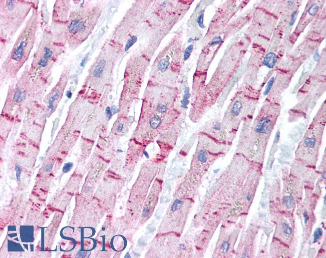 Anti-STEAP4 antibody IHC of human heart. Immunohistochemistry of formalin-fixed, paraffin-embedded tissue after heat-induced antigen retrieval. Antibody LS-B1407 concentration 5 ug/ml.