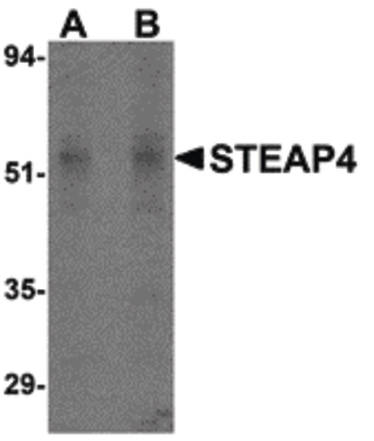 Western blot of STEAP4 in rat liver tissue lysate with STEAP4 antibody at (A) 0.5 and (B) 1 ug/ml.