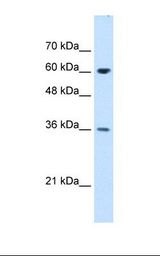 Jurkat cell lysate. Antibody concentration: 1.25 ug/ml. Gel concentration: 12%.