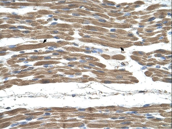 STIP1 antibody LS-C80846 was used in IHC to stain formalin-fixed, paraffin-embedded human muscle.