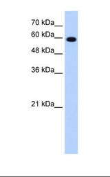 Jurkat cell lysate. Antibody concentration: 1.25 ug/ml. Gel concentration: 12%.
