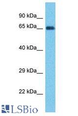 PTPN22 / PEP antibody Western Blot of Thyroid Tumor. Antibody dilution: 1 ug/ml.