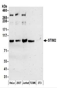 Detection of Human and Mouse STIM2 by Western Blot. Samples: Whole cell lysate (50 ug) prepared using NETN buffer from HeLa, 293T, Jurkat, mouse TCMK-1, and mouse NIH3T3 cells. Antibodies: Affinity purified rabbit anti-STIM2 antibody used for WB at 0.1 ug/ml. Detection: Chemiluminescence with an exposure time of 3 minutes.