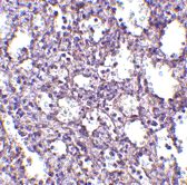 Immunohistochemistry of formalin-fixed, paraffin-embedded human spleen stained with Rabbit anti-Human STIM2 following heat mediated antigen retrieval using sodium citrate buffer (pH6.0)