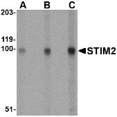 Western blot of whole cell lysate from A20 mouse B-cell lymphoma cells probed with Rabbit anti-Human STIM2 at 0.5(A), 1(B) and 2(C) ug/ml